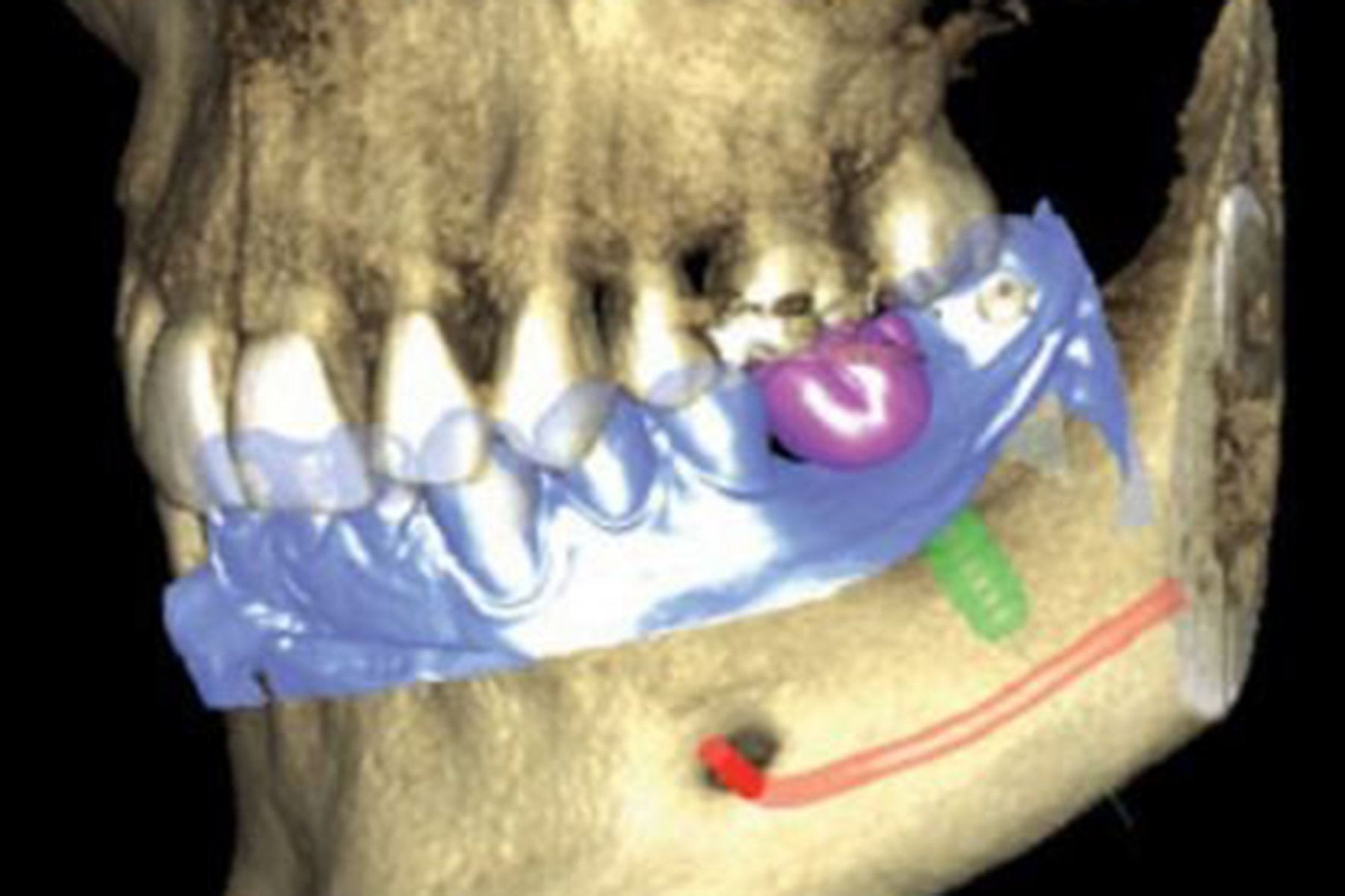 cbct.jpg