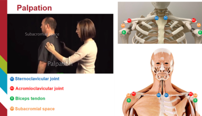 Physical Examination of the Shoulder | E-Gallery | University of ...