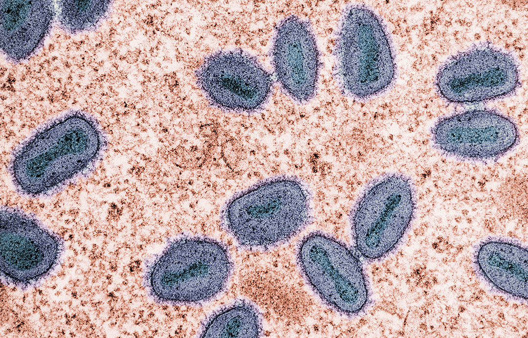 Mpox Virus 