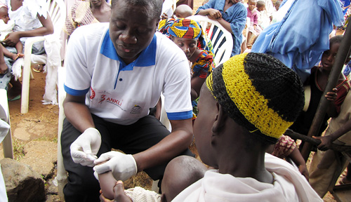 As part of a community survey for sickle cell disease,
Stephen Obaro, M.D., Ph.D., takes blood samples from
children living in Gwantu, Nigeria, during a visit last
year. Sickle cell disease is a common, inherited blood
disorder that increases susceptibility to certain types
of serious bacterial infections.