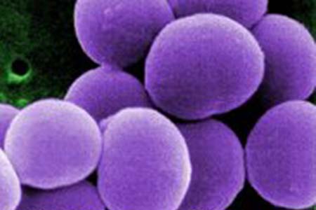 Magnification shows a strain of S. aureus bacteria. Source: CDC/Matthew J. Arduino, DRPH.