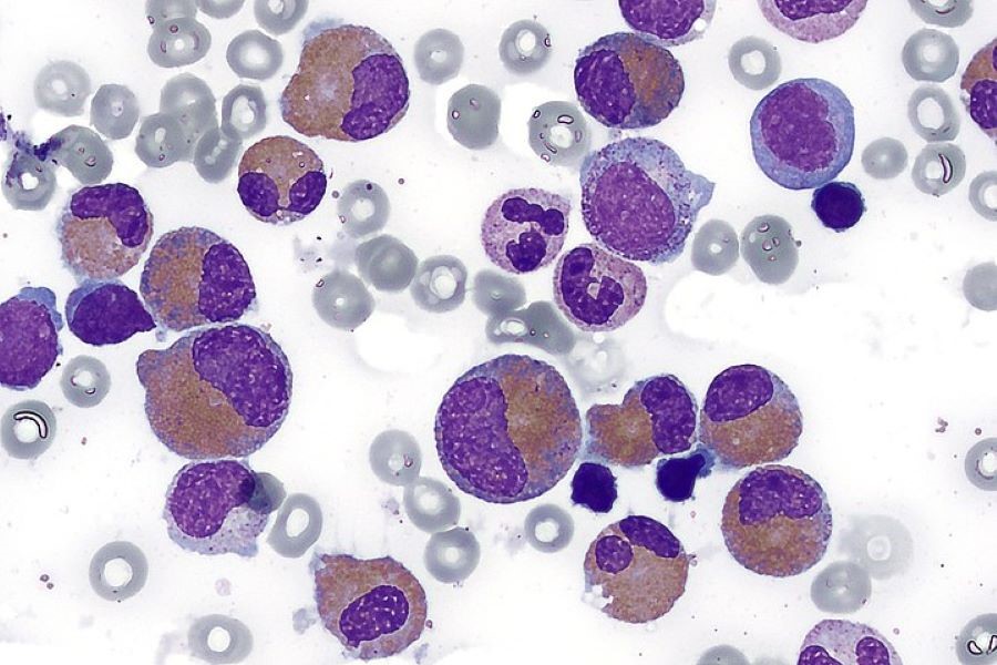 Bone Marrow Cells