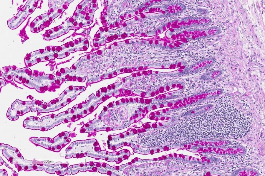 Human Intestine Cells