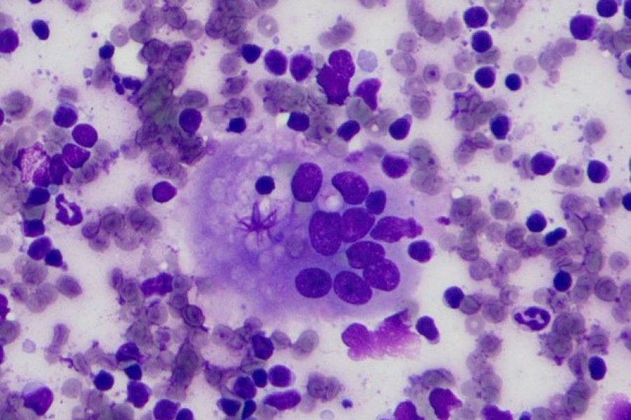 Dt Lynn cytopath image