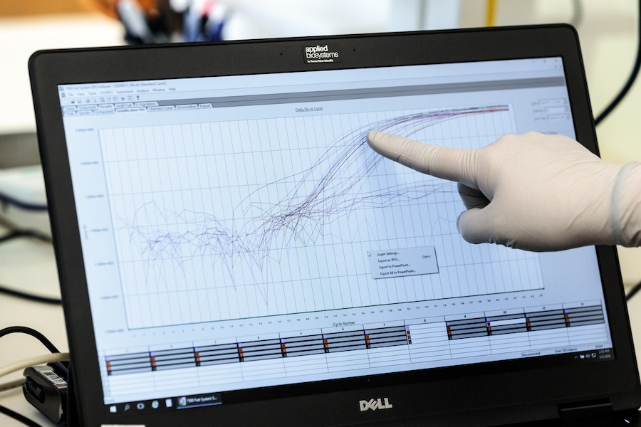 A gloved hand pointing at a bar graph on a screen.