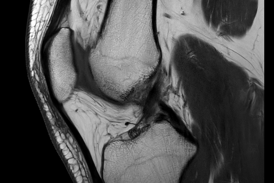 Radiologic image of a knee.