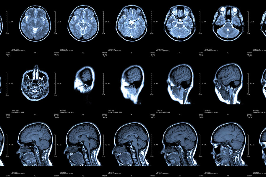 CT scan images of a brain.