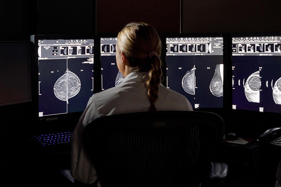 A department of radiology fellow reads mammography scans.