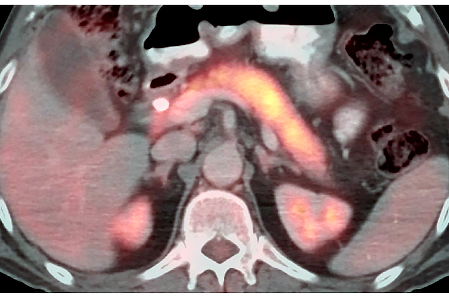 PET/CT imaging uses radiotracers to assess the metabolic or biochemical function of tissues and organs